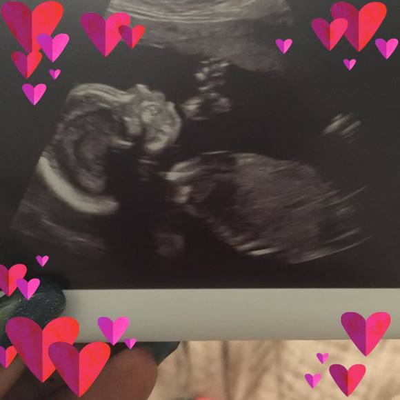 Meet your Posher, Lebronna - Picture 1 of 1